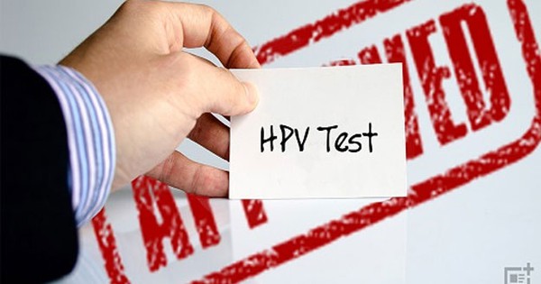 Nữ giới dưới 30 tuổi có nên xét nghiệm HPV?