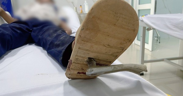 Bé trai bị thanh sắt đâm xuyên bàn chân