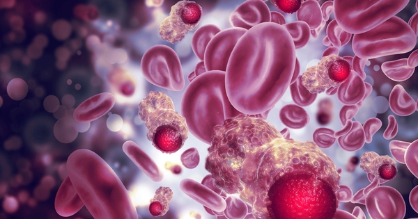 Cảnh báo: Điều nhiều người "xem nhẹ" có thể kích hoạt ung thư máu