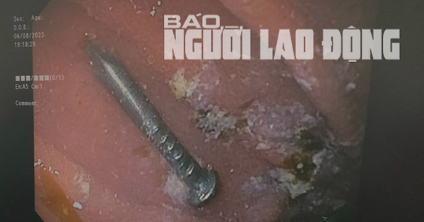 Bé trai gặp nguy hiểm khi nuốt cây đinh lúc đang chơi đùa