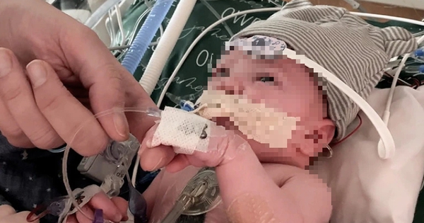 Em bé đầu tiên thế giới sống khỏe nhờ ghép một phần trái tim