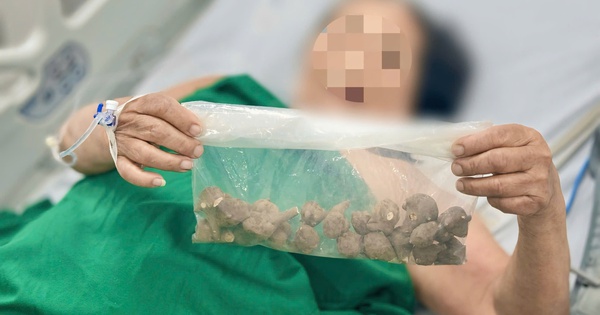 Ăn loại củ quen thuộc chữa xương khớp, cụ b&agrave; nguy kịch
