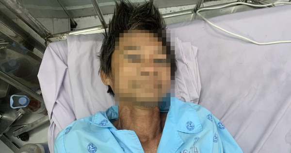 Tìm thân nhân người đàn ông bất tỉnh ngoài đường ở phường Tam Bình, TP HCM