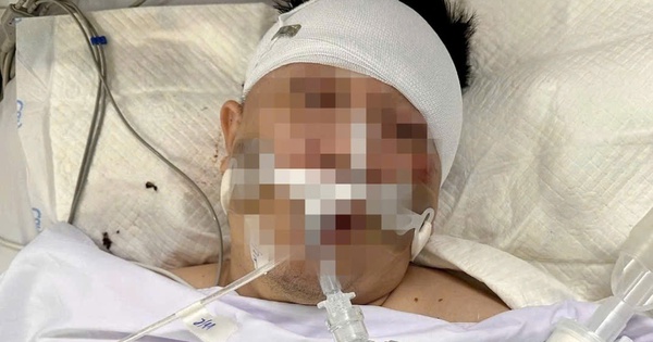 Luật sư lên tiếng vụ người đàn ông nguy kịch khi xe tông trúng chó chạy rông