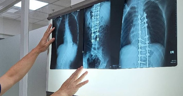 Bộ Y tế đề nghị không lấy thời gian chụp X-quang để từ chối BHYT