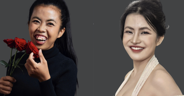 Khi ngoại hình trở thành 