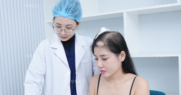 Bác sĩ Bùi Kiều Trang hướng dẫn điều trị rụng tóc kéo dài ở giới trẻ