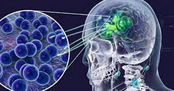 Thông tin liên quan ca dương tính viêm não mô cầu ở Cà Mau