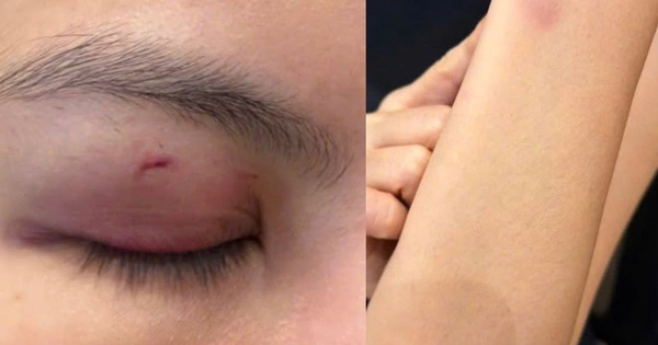 Công an phường Sài Gòn xác minh vụ ca sĩ Trung Quân Idol đánh phụ nữ