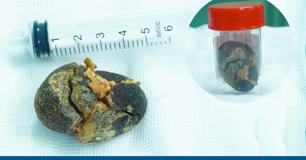 Đi khám sức khỏe định kỳ, người phụ nữ trẻ phát hiện điều bất ngờ