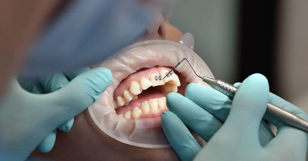 Mỗi hàm răng một phác đồ riêng nhờ nha khoa cá nhân hóa