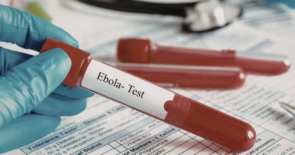TPHCM tăng cường giám sát cửa khẩu, chủ động phòng nguy cơ dịch bệnh Ebola xâm nhập