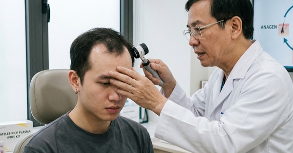 Người trẻ rụng tóc, hói đầu vì những thói quen tưởng vô hại