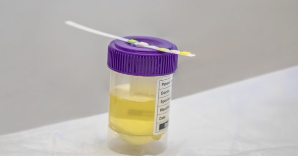 Vì sao dùng ma túy nhưng test nhanh vẫn âm tính?
