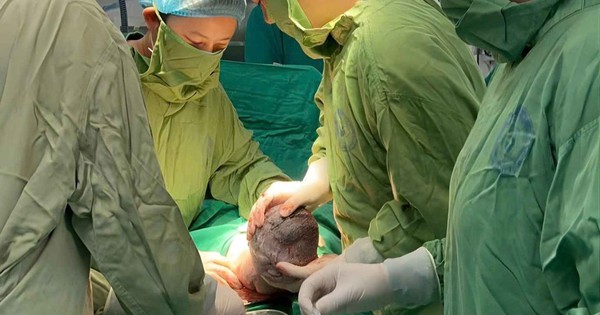 Can thiệp bào thai: Thêm cơ hội sống cho thai nhi từ trong bụng mẹ