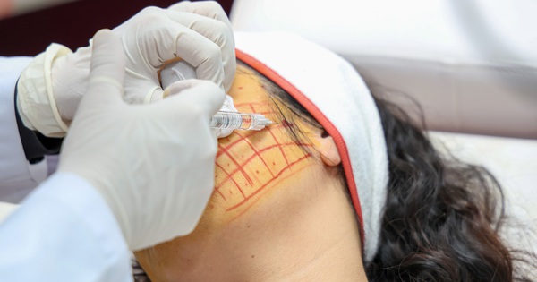Căng chỉ làm đẹp, cô gái phải lấy dị vật dưới da