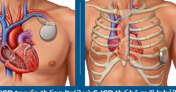 Lần đầu tiên đặt máy phá rung tim công nghệ mới