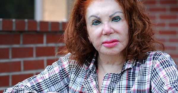 Mẹ sao “Rambo” biến dạng, bệnh tật vì dao kéo